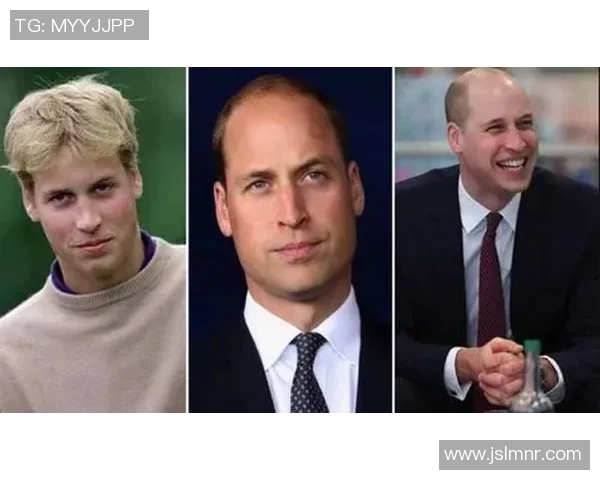 足球明星为何能保持浓密秀发揭秘背后的秘密与护发技巧